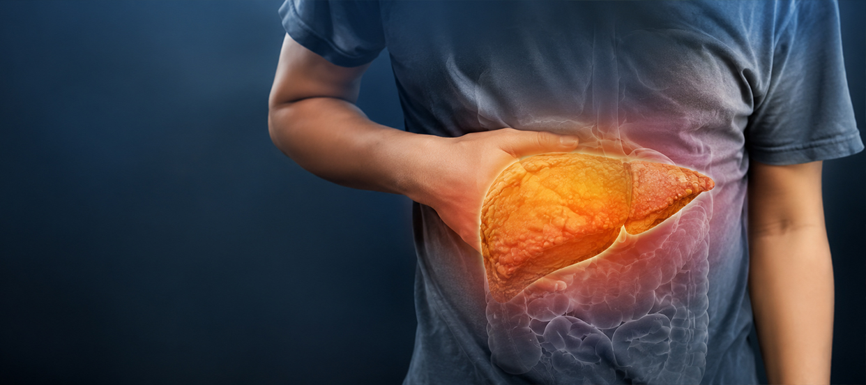Why Fatty Liver Disease Is Increasing Rapidly in Young Adults
